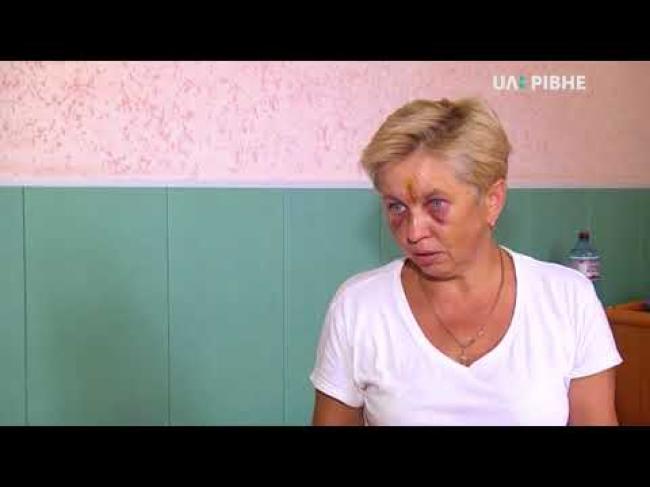 Рівненська лікарка швидкої допомоги отримала удар в лице на виклику (ВІДЕО)