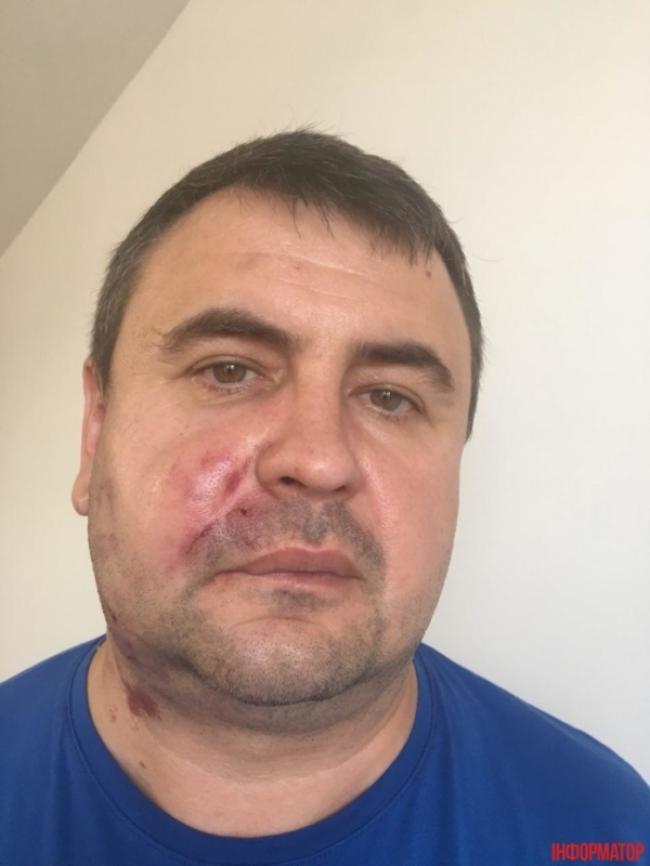 Федорчук відкидає звинувачення у побитті рівненського депутата