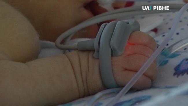 Недоношена дитина, якій зробили операцію на серці, видужує