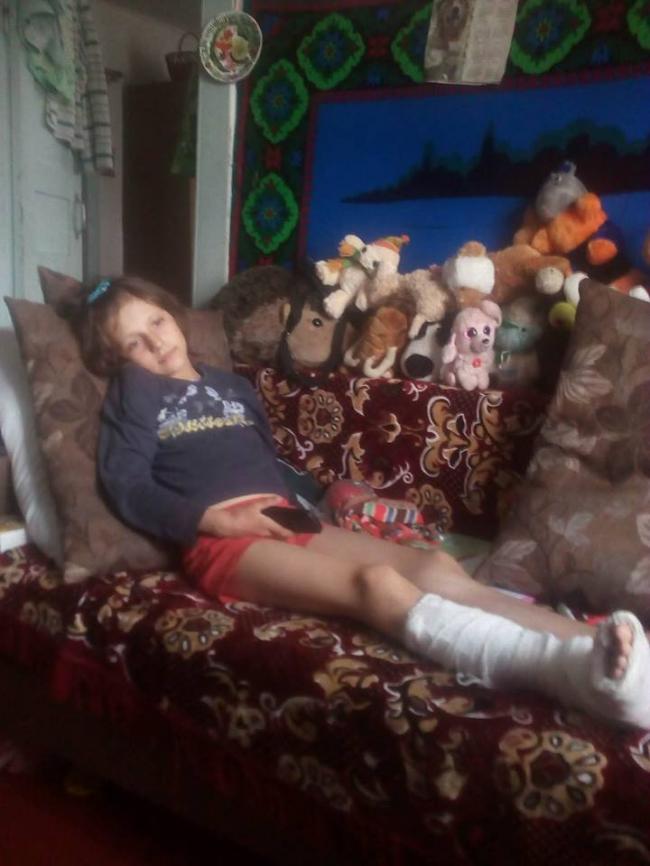 10-річна мешканка Рівненщини бореться з важкими хворобами