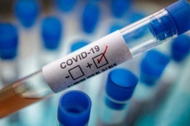Рівненщина - на 5-му місці: в Україні за добу виявили понад пів тисячі нових хворих на коронавірус