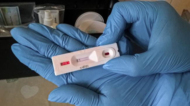 На Рівненщині проводять ІФА-тести на визначення антитіл до коронавірусу: де можна зробити та яка ціна