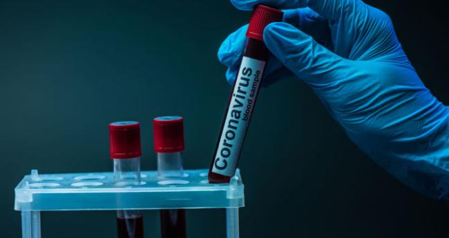 Новий антирекорд: майже 1200 інфікувань коронавірусом за добу