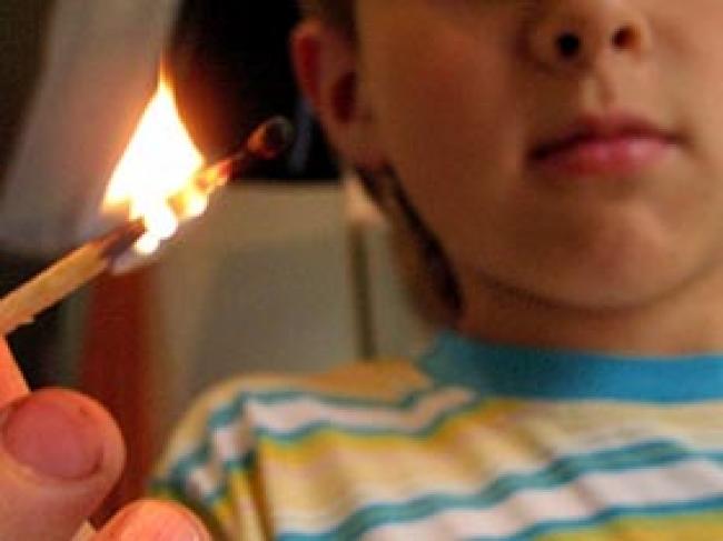 На Рівненщині через дитячі ігри з вогнем обпікся однорічний малюк