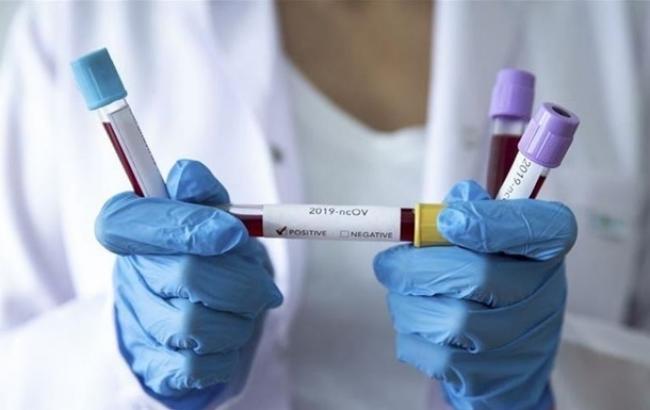 Новий спалах коронавірусу на Рівненщині: сьогодні в області +60 хворих