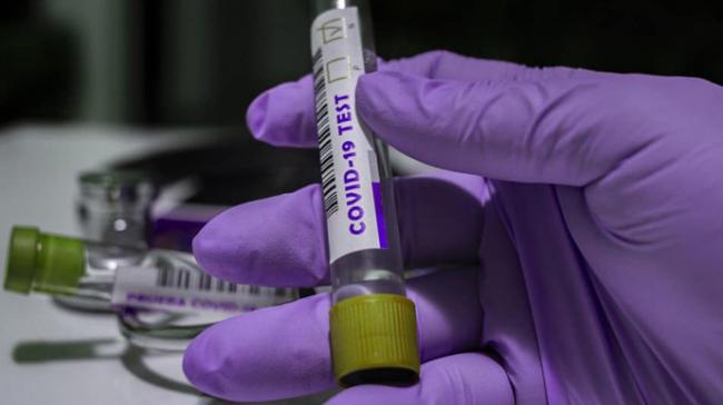 Майже 700 підозр на коронавірус перевіряють рівненські лабораторії