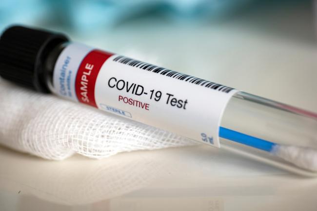 У 24 жителів Рівненщини лабораторно підтвердили коронавірус