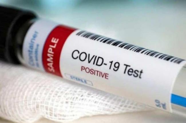 У Рівненській області ще у 28 осіб діагностували COVID-19