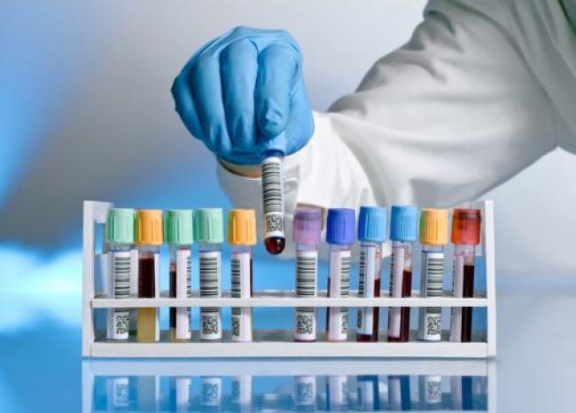 На Рівненщині зростає попит на тестування: за добу лабораторії роблять понад 2 тисячі досліджень