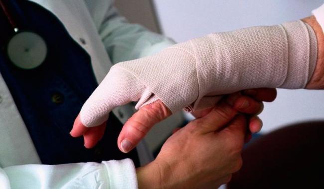 Сам прийшов до медиків: на Рівненщині чоловік отримав опіки рук під час гасіння пожежі