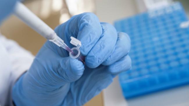 На Рівненщині у 93 людей підтвердили коронавірус