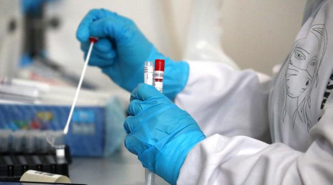 На Рівненщині виявили 38 нових випадків коронавірусу