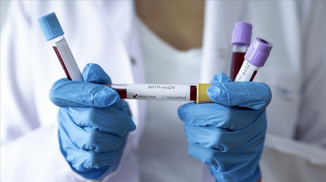 Коронавірус на Рівненщині: випадки інфікування зафіксували у двох районах