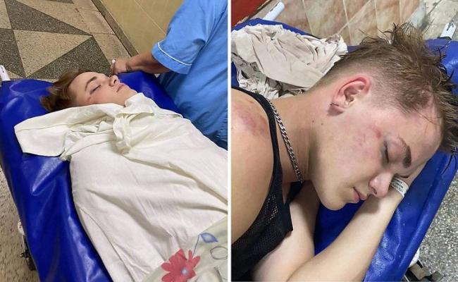 Був крововилив у мозок: танцюриста Дорофєєвої жорстоко побили біля гей-клубу