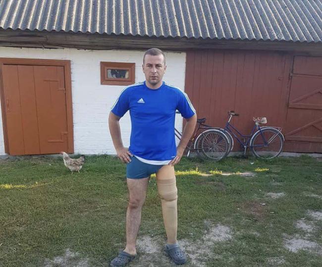 Молодий чоловік із Рівненщини втратив ногу після аварії: йому збирають гроші на протез