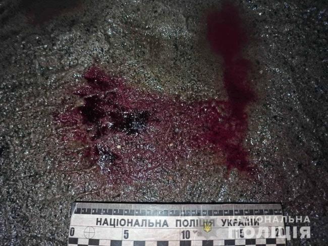 На Рівненщині чоловік після хрестин порізав свого кума: потерпілий у лікарні