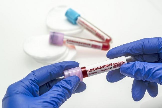 На Рівненщині коронавірус виявили ще у понад трьох сотень людей