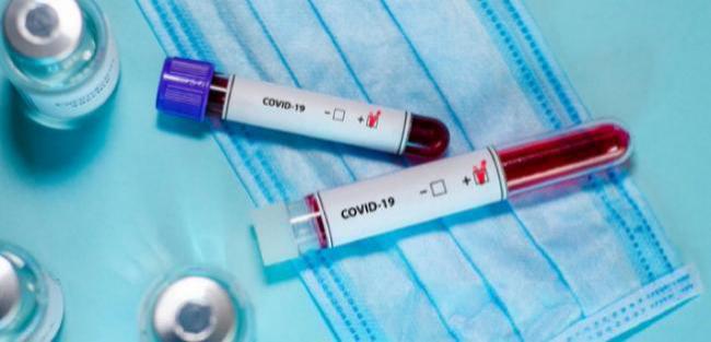 На Рівненщині ще понад півтисячі людей захворіли на covid-19