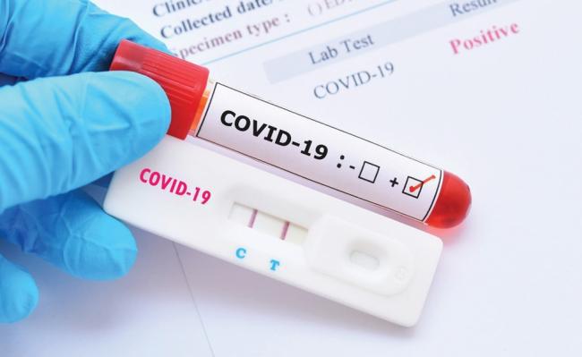 На Рівненщині за добу COVID-19 підтвердили в 131 хворого