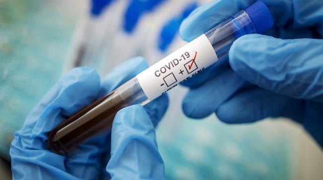 На Рівненщині зафіксували понад шість сотень нових випадків коронавірусу