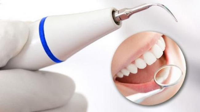 Професійне чищення зубів ультразвуком - переваги і протипоказання