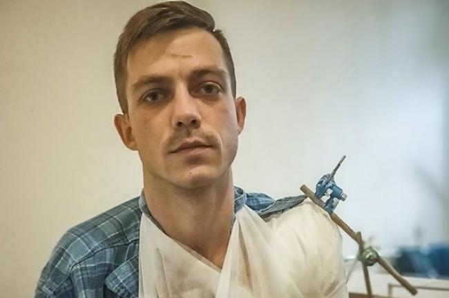 Росіяни кинули у нього десяток гранат: історія нацгвардійця, який відбив ворожий напад та врятував побратима