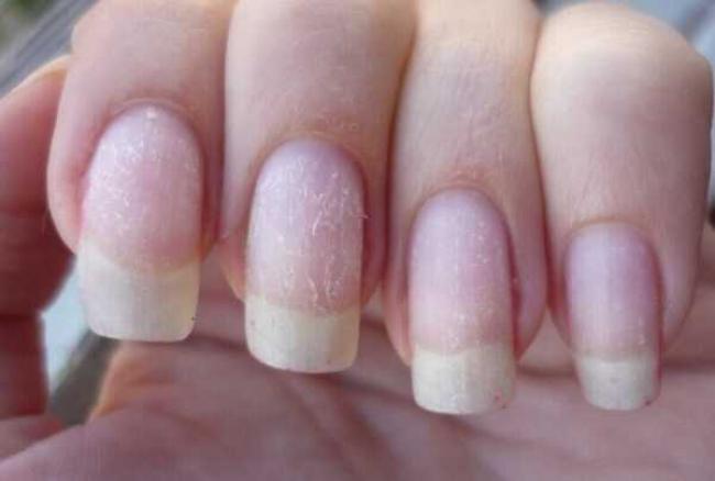 Як відновити нігті після гель-лаку: три перевірених способи